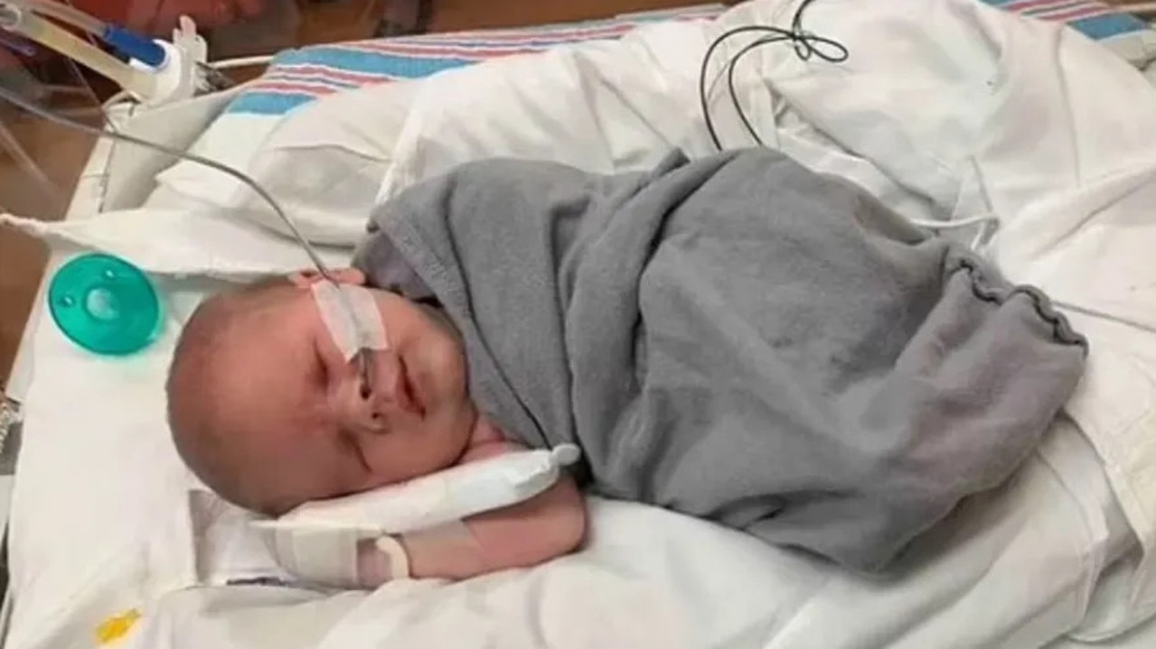 Baby Born Without Eyes: Living With Bilateral Anophthalmia Baby Born Without Eyes: Living With Bilateral Anophthalmia