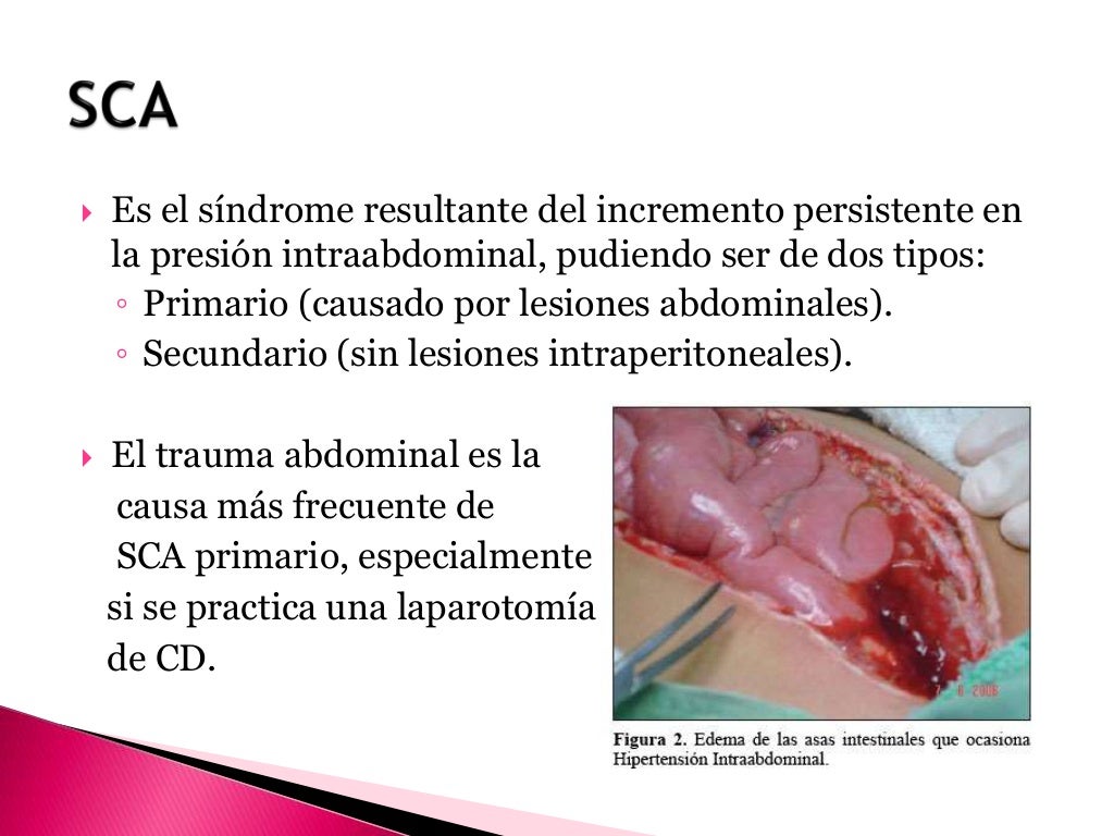 Control De Daños: Prevenir Actos Imprudentes De Personas Inexpertas Control De Daños: Prevenir Actos Imprudentes De Personas Inexpertas