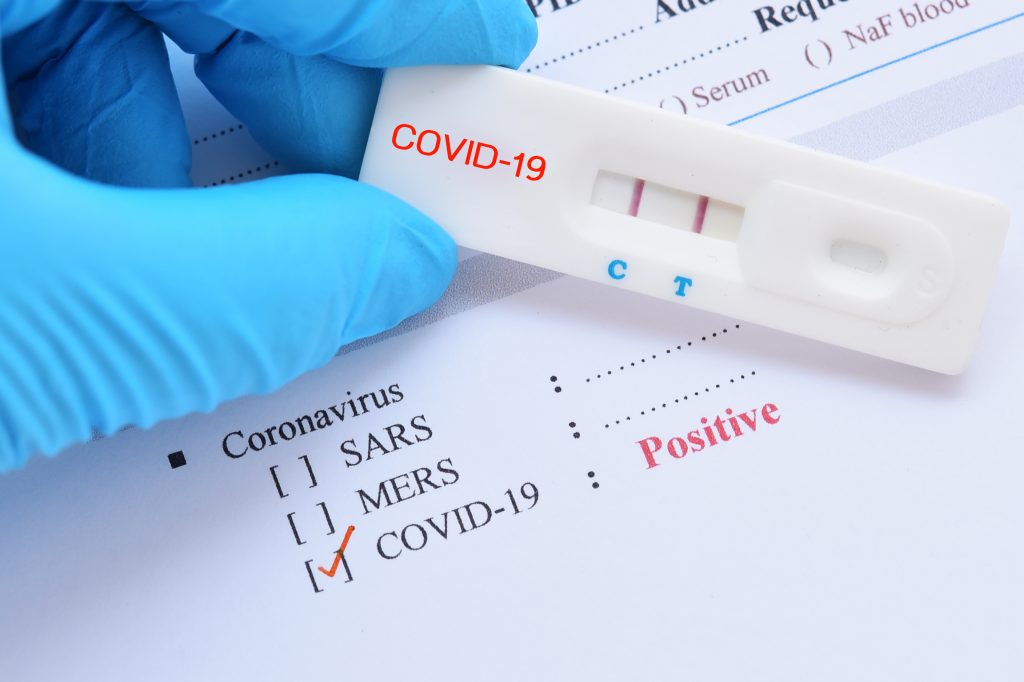 COVID-19 Test Fraud: Lab Owner Convicted Of Falsifying Results COVID-19 Test Fraud: Lab Owner Convicted Of Falsifying Results