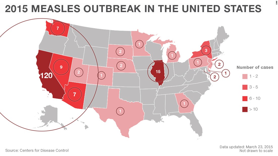Current Measles Outbreak: Areas Affected In The United States Current Measles Outbreak: Areas Affected In The United States