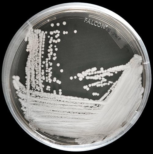 Deadly Fungi: The Emerging Superbug Crisis Deadly Fungi: The Emerging Superbug Crisis