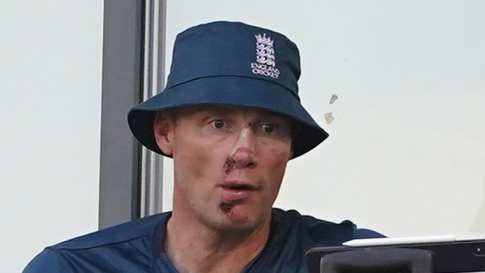 Freddie Flintoff's Car Crash: Freddie Flintoff's Car Crash: