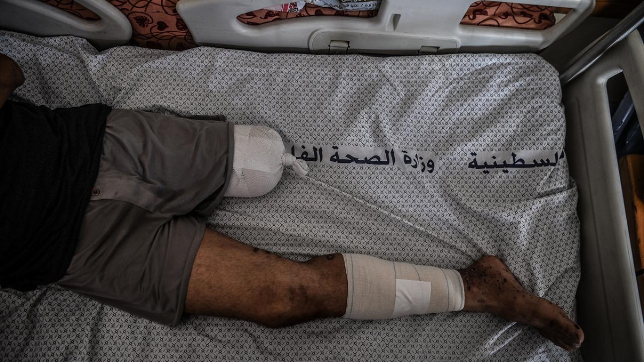 Gazze'deki Filistinli Mültecilerin Günlük Hayatı Ve Zorlukları Gazze'deki Filistinli Mültecilerin Günlük Hayatı Ve Zorlukları