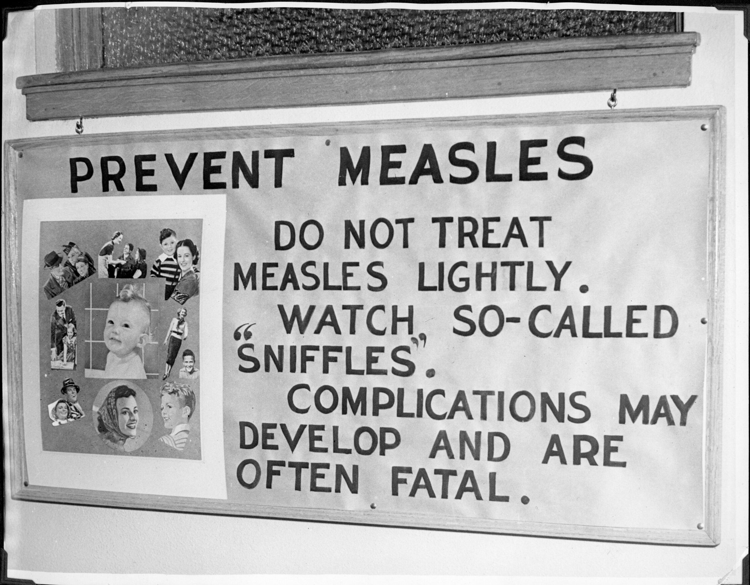Is Canada On The Brink Of Losing Its Measles Elimination Status? Fall 2024 Concerns Is Canada On The Brink Of Losing Its Measles Elimination Status? Fall 2024 Concerns
