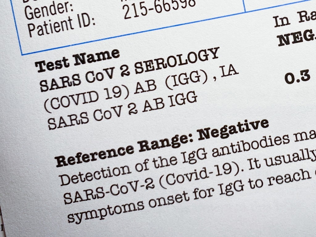 Lab Owner Convicted: Guilty Plea For Fabricating COVID-19 Test Results Lab Owner Convicted: Guilty Plea For Fabricating COVID-19 Test Results