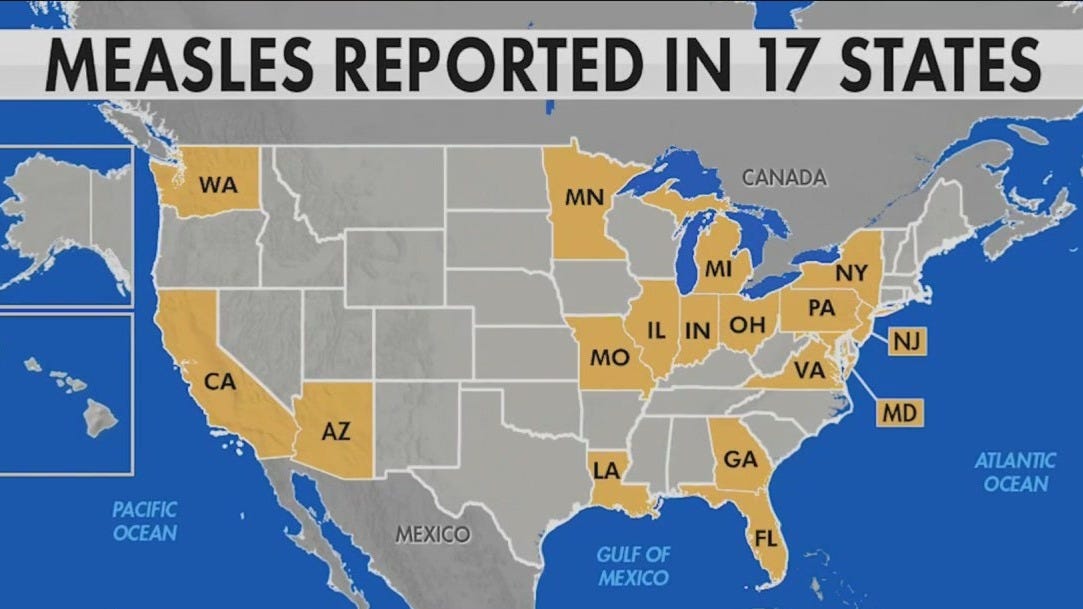 Measles Cases Rising: Latest Updates On The U.S. Outbreak Measles Cases Rising: Latest Updates On The U.S. Outbreak