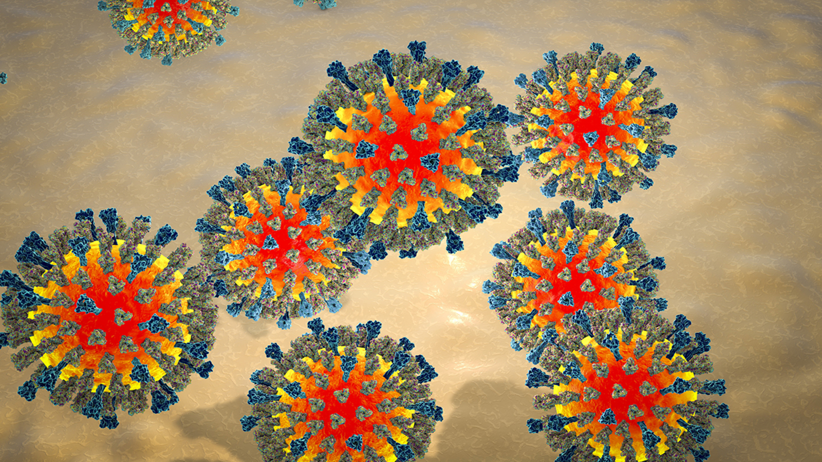 Measles Outbreak In The U.S.: Locations And Case Numbers Measles Outbreak In The U.S.: Locations And Case Numbers