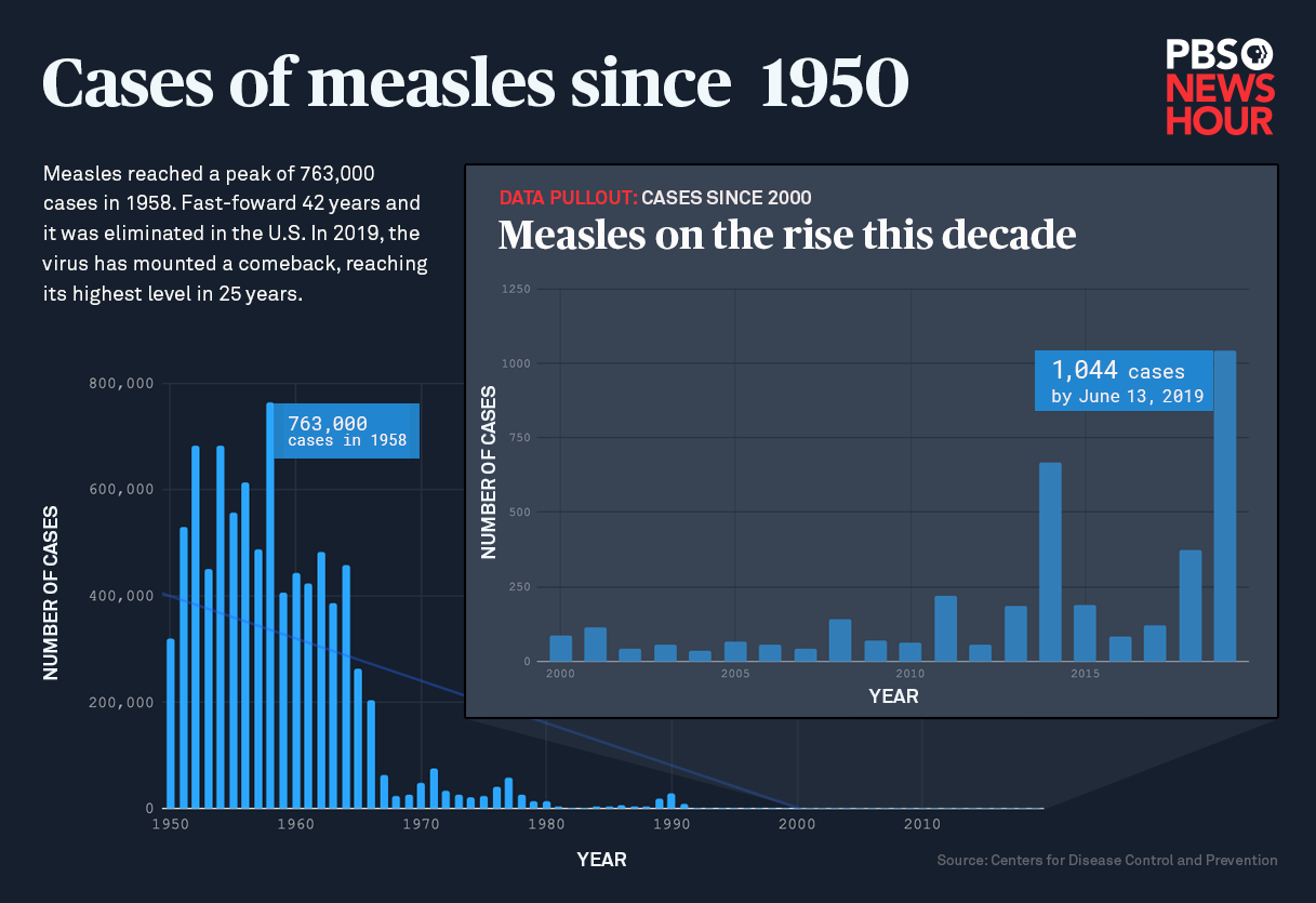 Measles Outbreak Updates: Current Spread In The U.S. Measles Outbreak Updates: Current Spread In The U.S.