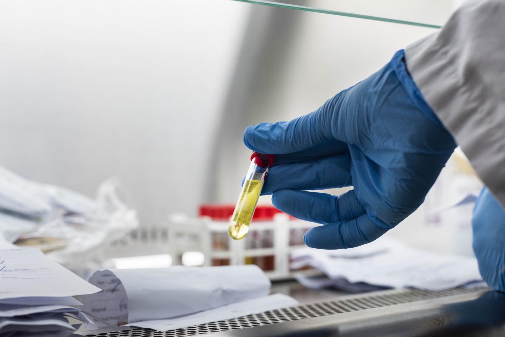 New COVID-19 Variants BA.1 And LF.7 Detected In India: What's The Risk? New COVID-19 Variants BA.1 And LF.7 Detected In India: What's The Risk?