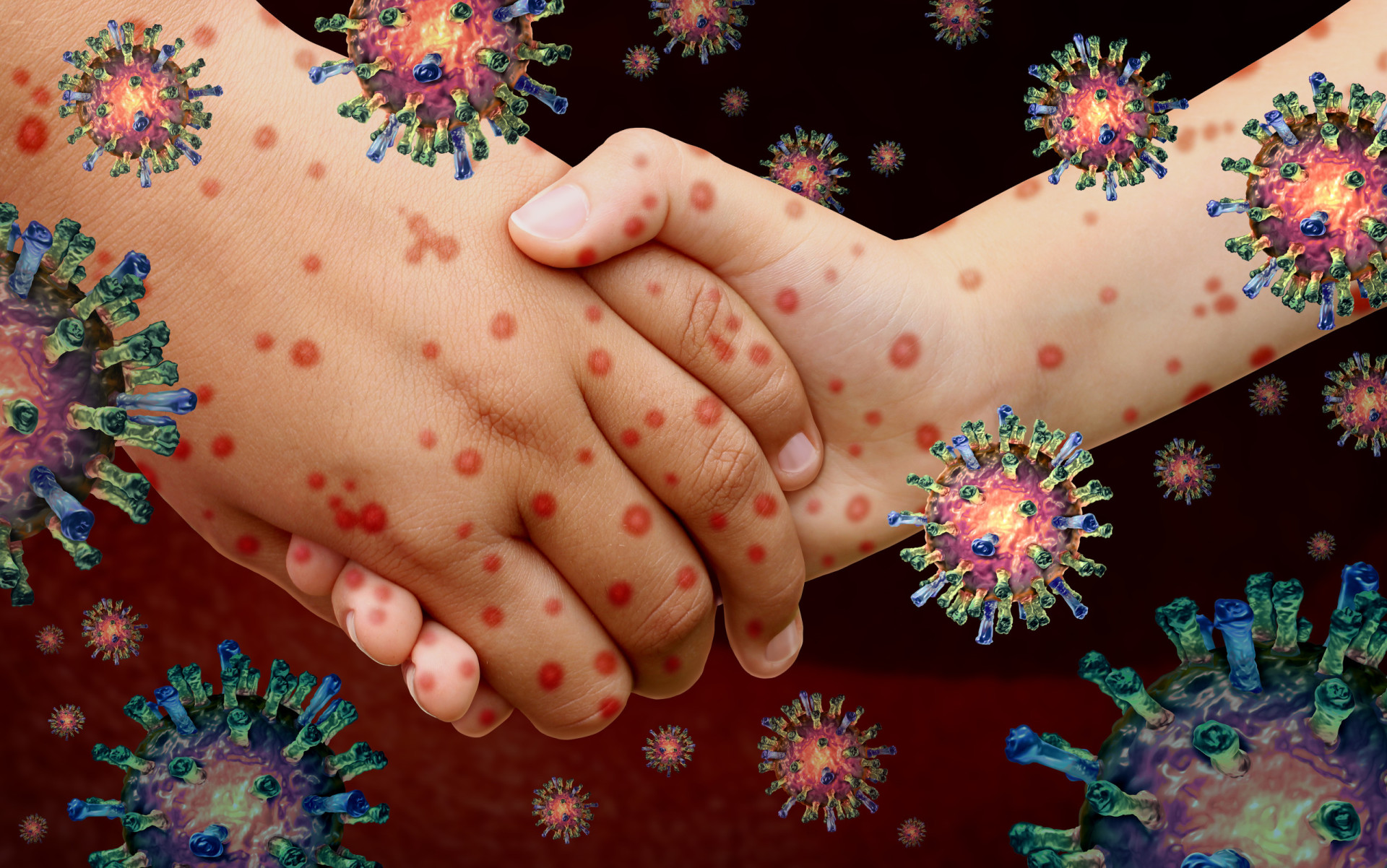 New Data Points To Respiratory Virus As Sole Cause Of Kawasaki Disease New Data Points To Respiratory Virus As Sole Cause Of Kawasaki Disease
