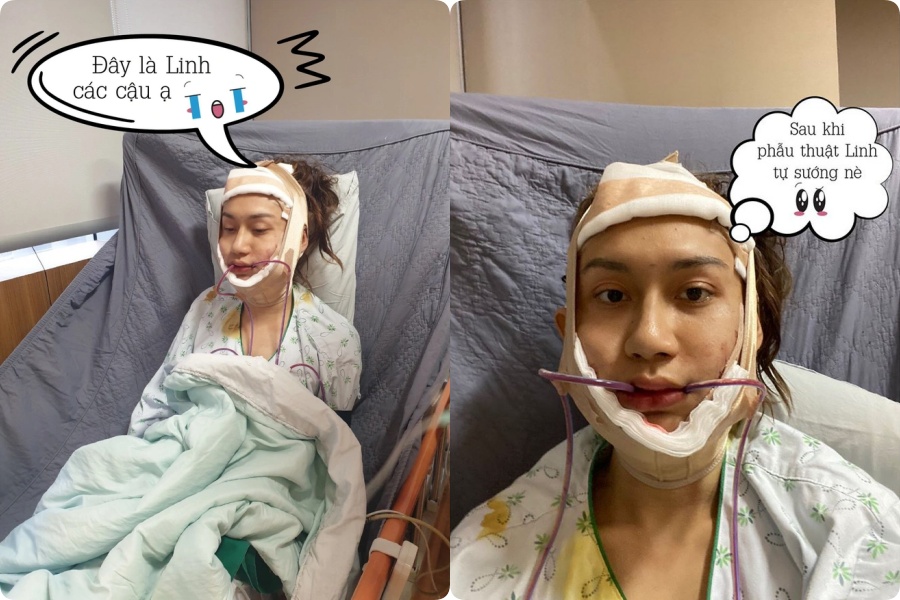 Nhan Sắc Thăng Hạng Của Lynk Lee Sau Chuyển Giới Nhan Sắc Thăng Hạng Của Lynk Lee Sau Chuyển Giới