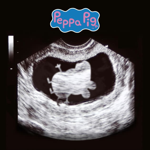 Peppa Pig's Mummy's Baby Gender Reveal: A New Arrival! Peppa Pig's Mummy's Baby Gender Reveal: A New Arrival!