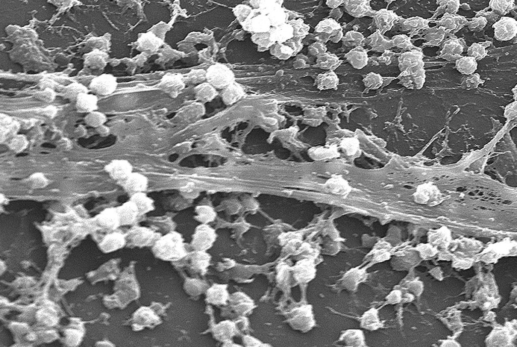 Presenza Di Microplastiche Nelle Acque: Una Panoramica Presenza Di Microplastiche Nelle Acque: Una Panoramica
