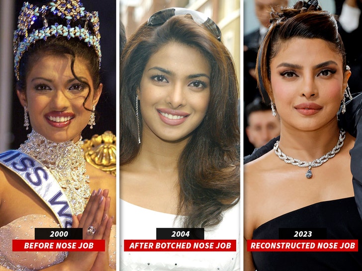 Priyanka Chopra's Botched Nose Surgery And Her Father's Reaction Priyanka Chopra's Botched Nose Surgery And Her Father's Reaction