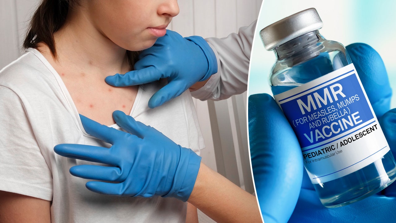Rising Measles Cases In Kansas: What You Need To Know Rising Measles Cases In Kansas: What You Need To Know
