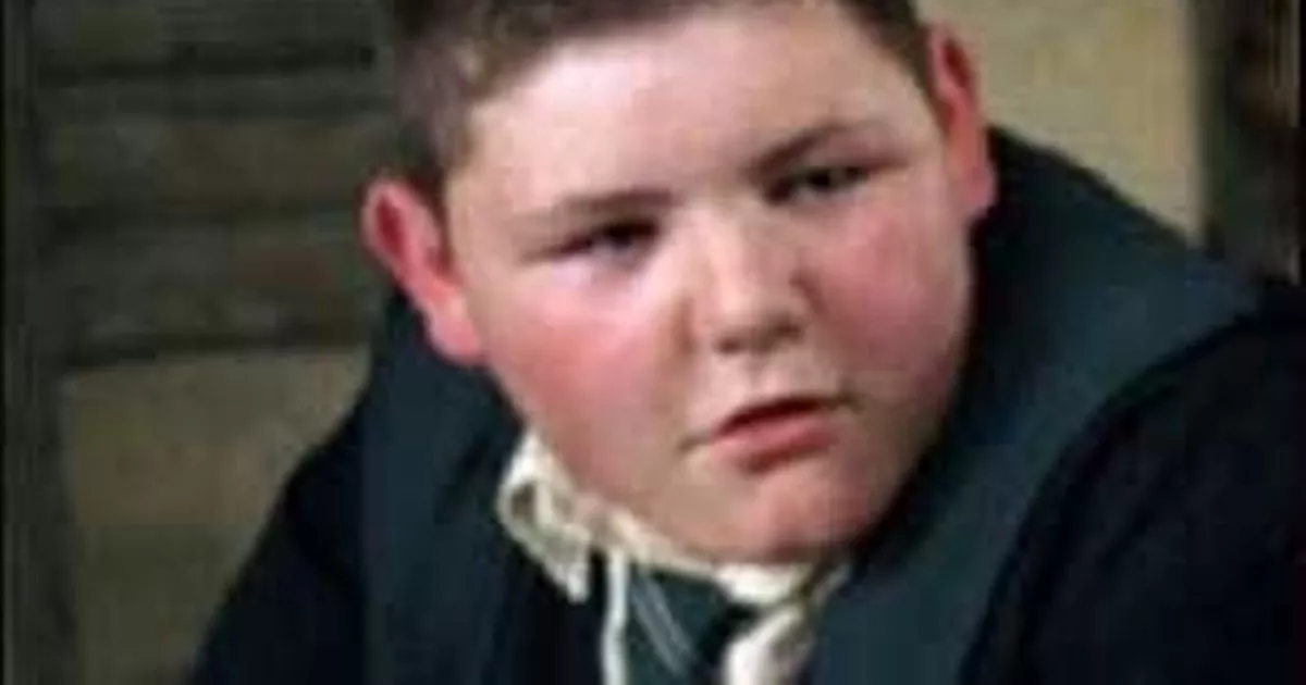 See How Harry Potter's Crabbe Looks Now: A Dramatic Change See How Harry Potter's Crabbe Looks Now: A Dramatic Change