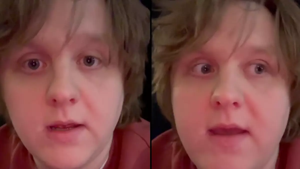 Singer Lewis Capaldi Announces Return After Extended Hiatus Singer Lewis Capaldi Announces Return After Extended Hiatus