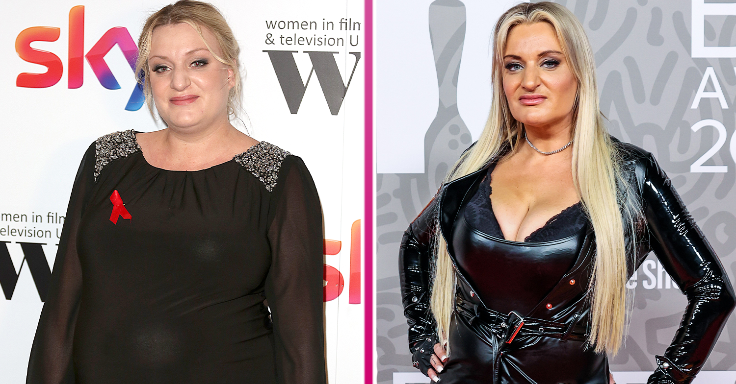 The Truth About Daisy May Cooper's Transformation: Weight And Fillers The Truth About Daisy May Cooper's Transformation: Weight And Fillers