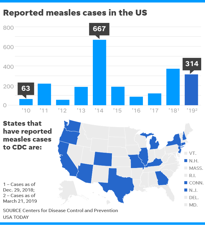 Understanding The Current Measles Outbreak In The USA Understanding The Current Measles Outbreak In The USA