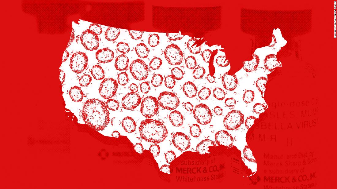 US Measles Outbreak Update: 1,046 Cases, Indiana Outbreak Ends US Measles Outbreak Update: 1,046 Cases, Indiana Outbreak Ends
